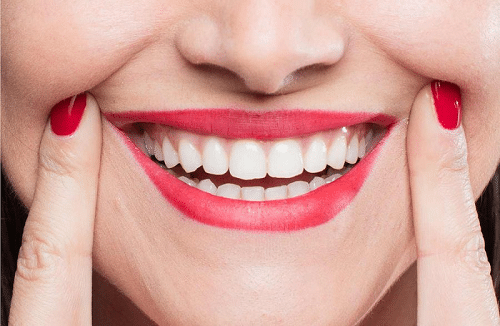 Bọc răng sứ titan có tốt không, có ảnh hưởng gì đến sức khỏe?