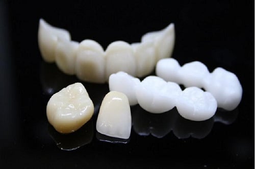Những sự thật về răng sứ không kim loại không phải ai cũng biết