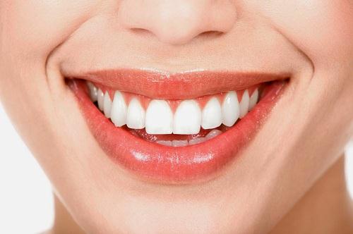 Như thế nào mới được gọi là có được hàm răng sứ đẹp?