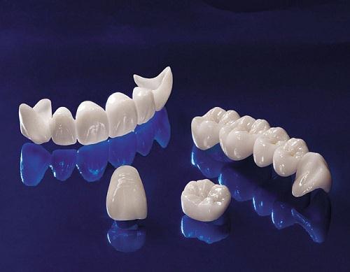 Răng sứ Zirconia là gì, giá răng sứ zirconia hiện nay bao nhiêu?